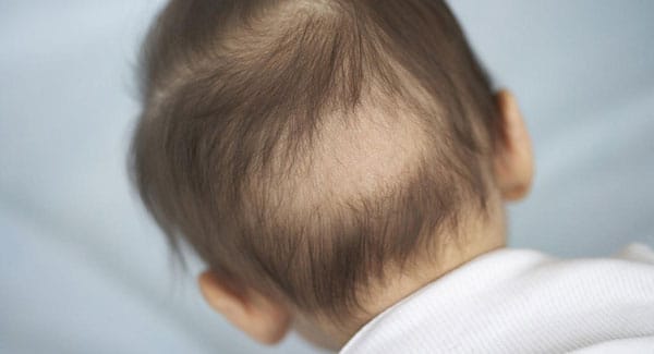 رازهایی در خصوص موی کودکان