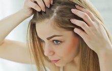 انواع ریزش موی سر و درمان آن
