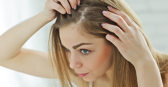 انواع ریزش موی سر و درمان آن