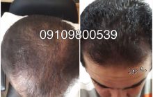 انواع ماسک مو را درخانه تهیه کنید