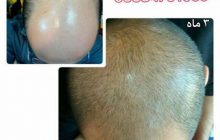 میوه هایی که برای رشد مو عالی میباشند