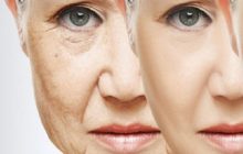 پیری پوست را چگونه درمان کنیم؟ +نکات کلیدی
