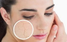 اینگونه خشکی پوست در زمستان مقابله کنید