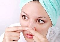 با این ماسک از جوش های سرسیاه خلاص شوید