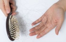 چه زمانی ریزش مو، ژنتیکی نیست؟