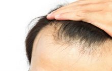کاهش وزن چه ارتباطی با ریزش مو دارد؟
