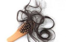 همه چیز درباره ریزش مو