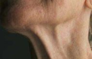 روش های جلوگیری از افتادگی پوست گردن