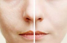 راههای طبیعی و دائمی برای کاهش منافذ پوست
