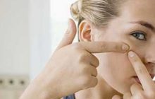 برای از بین بردن جوش و آکنه چی بخوریم، چی نخوریم؟