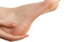 با ترک پاشنه پا چه کنیم؟