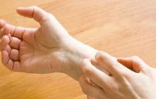 کاهش خارش کهیر مزمن با این ۹ روش