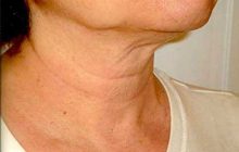 پیشگیری از چروک پوست گردن با این روش ها