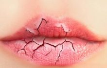 ترک لب را به راحتی درمان کنیم