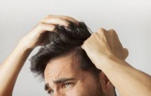 بهترین راههای جلوگیری از ریزش موی مردان