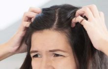 آنچه باید درباره خارش پوست سر بدانید