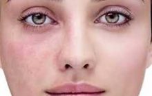 لک‌های پوستی چرا و چطور ظاهر می‌شوند؟