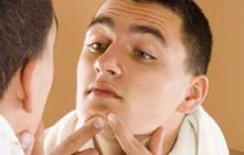 برای جلوگیری و کنترل آکنه چه باید کرد؟