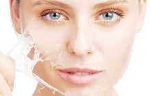لایه برداری پوست و پاسخ به سوالات متداول