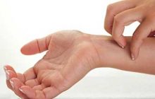 حساسیت پوستی اذیت تان می کند؟