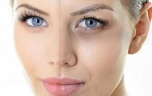 روشهای سریع برای رهایی از سیاهی و پف زیر چشم