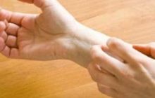 خارش پوست این قسمتهای بدن بایدشمارانگران کند