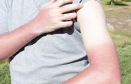 مشکلات پوستی در فصل گرما