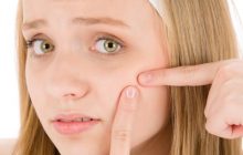 چگونه با روشی ساده جوش های صورت را از بین ببریم؟ +پیشنهاد جالب