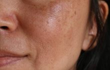 تیرگی پوست مهم‌ترین عارضه استفاده از لوازم آرایشی نامرغوب